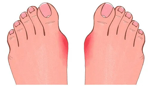 Curved Toe-RED
