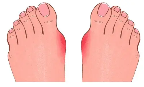 Curved Toe-RED