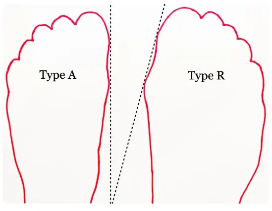 TYPES