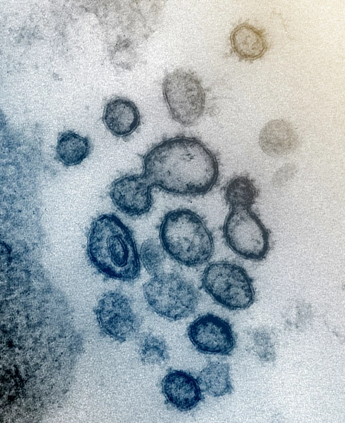 351665157-8d4126b770d3861d11a46ee407213a2e3fd28968d6b56bb6d862722fceec14dc.jpeg