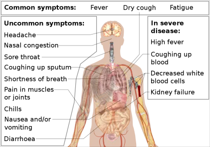 351665157-ac2825df91a5667c5ae739e4b5fef3da61f4598c7d02efa44d5e046aa9cbd3d1.png