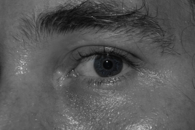 Sweaty Eye