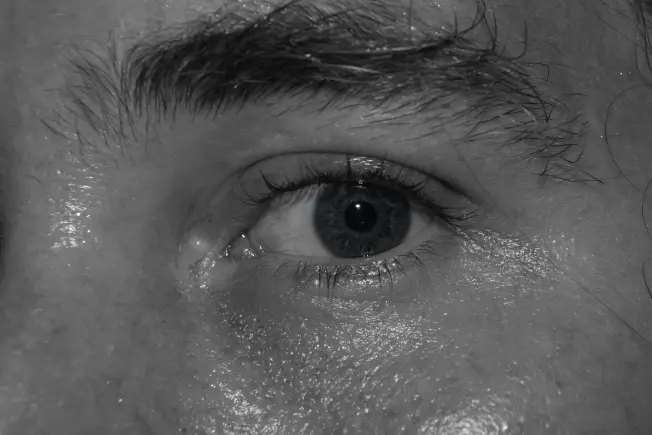 Sweaty Eye