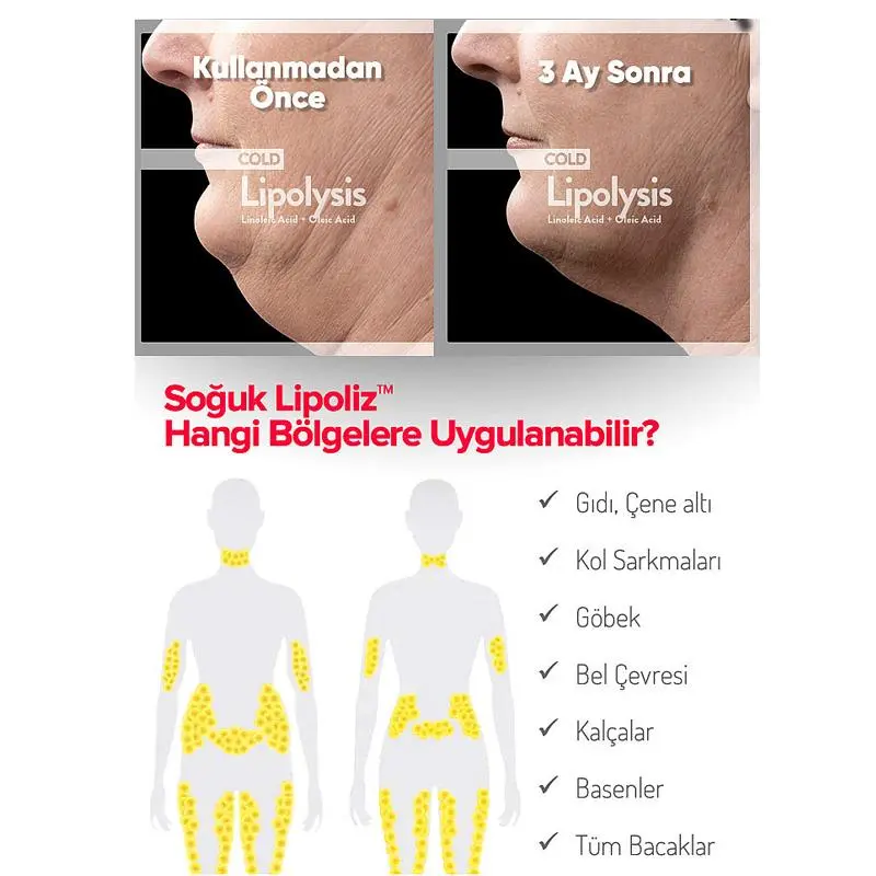 cold lipolysis jel kullanım öncesi e sonrası
