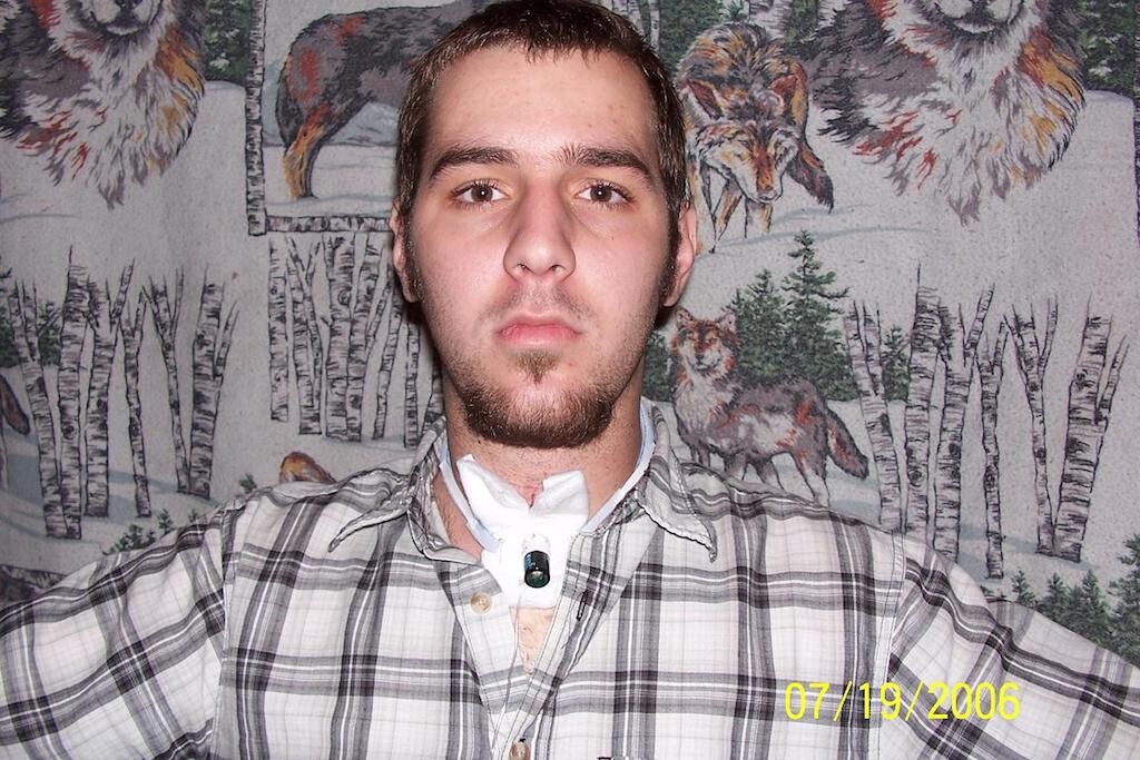 Me Very Depressed after being Trached so I Could Breath