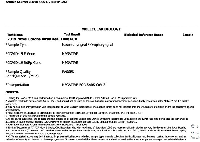 RT-PCR test , covid-19 test