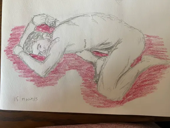 Bryant fetal position - 15 minutes