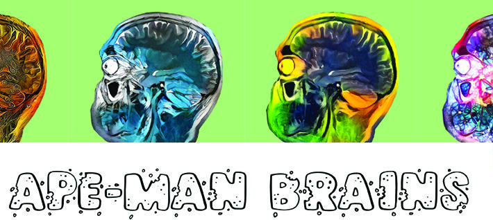 Brains 2