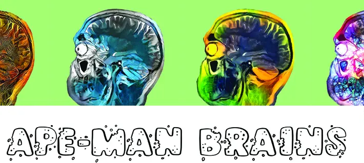 Brains 2