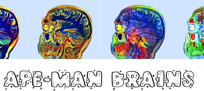 Brains