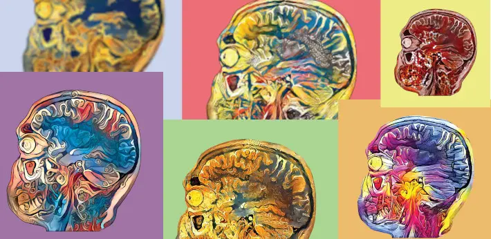 Brains