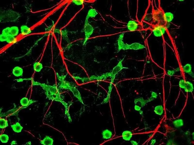 Microglia(green) cells, the immune cells in brain Source Author - GerryShaw CC BY-SA 3.0