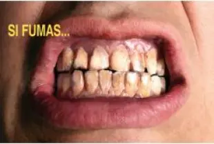 0f19cb296f82d9576690135ee198b1b9297932e16e18420cfff5696ae000cb77.jpg